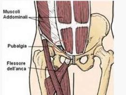 Pubalgia, come arriva e come curarla: l'approfondimento della Fisio Eur Gennari