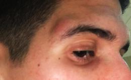 Violenza senza fine, testata a un arbitro in 2ª Categoria

