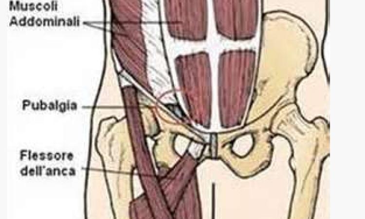 Pubalgia, come arriva e come curarla: l'approfondimento della Fisio Eur Gennari